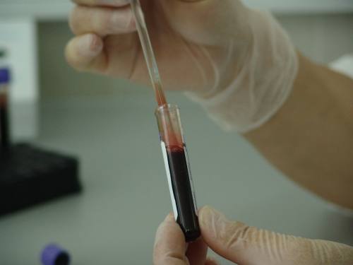 анализ крови в лаборатории