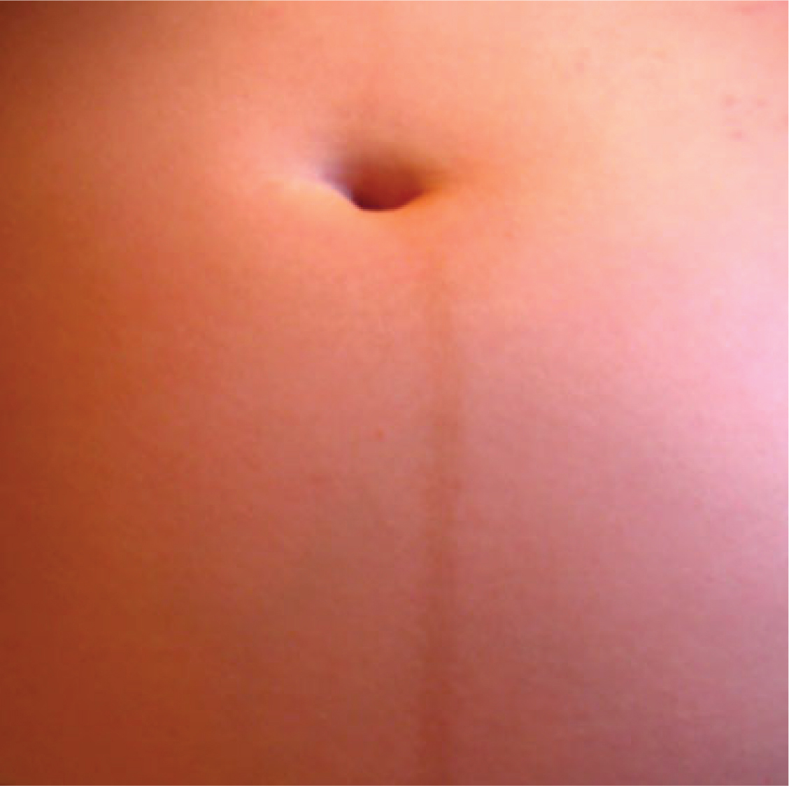 как выглядит грудь при беременности на первых неделях фото 51