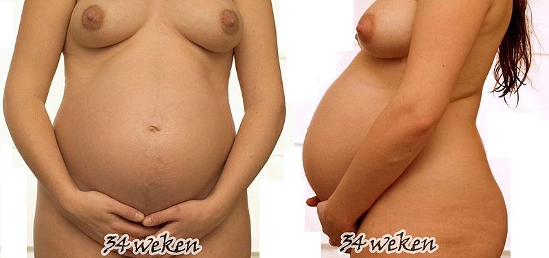 Женщина на 34 неделе беременности.