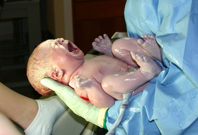 Новорожденный младенец через несколько секунд после рождения.